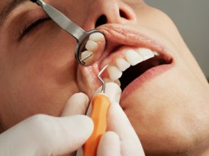 Soins & Examens Dentaire 75001