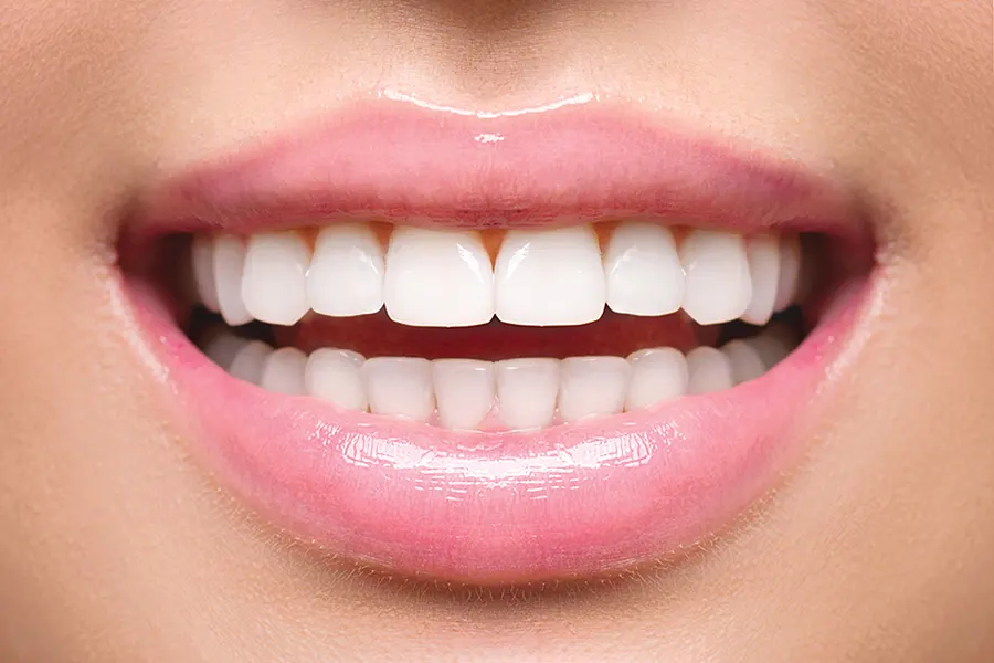 esthetisme des dents